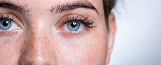 Dermatite e sensibilità oculare: quale correlazione?