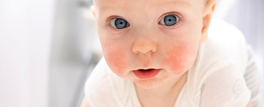 La routine quotidiana di un bambino con pelle atopica: lo sguardo di un genitore